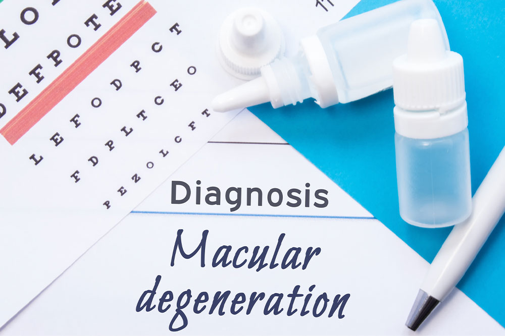 Macular Degeneration – Causes, Symptoms, and More